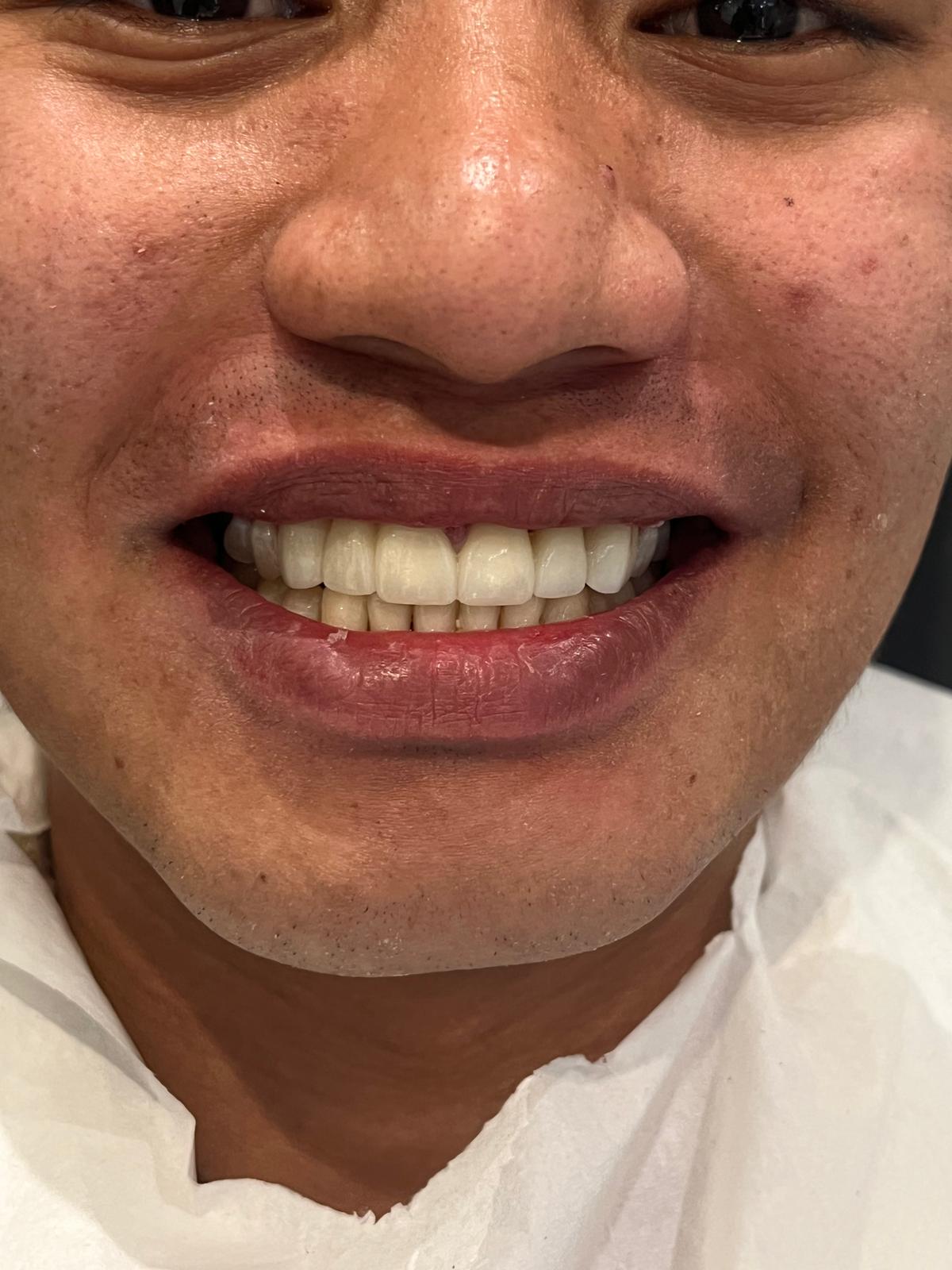 ECE Dental Patient Transformation